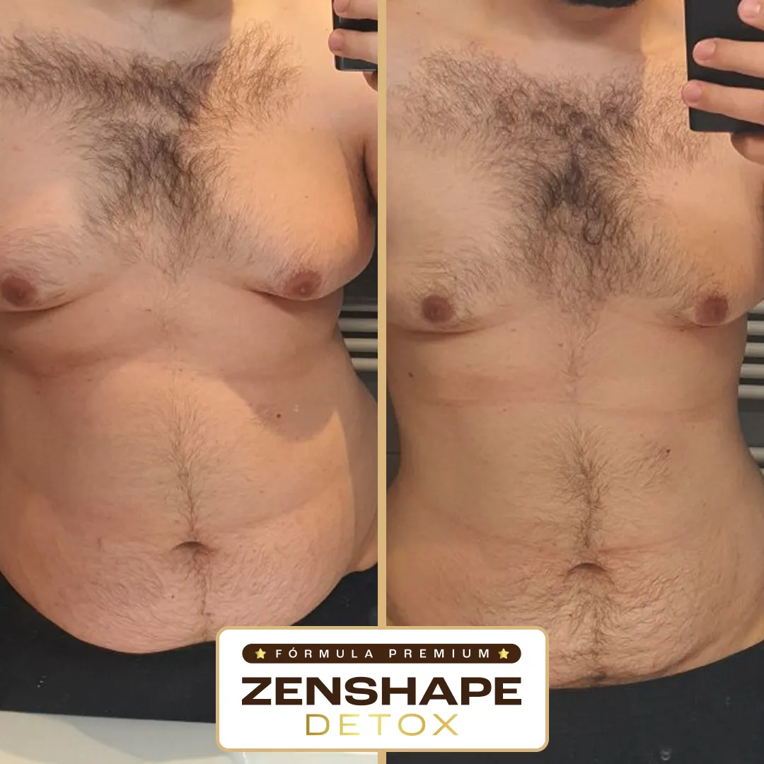 resultado_zenshape03